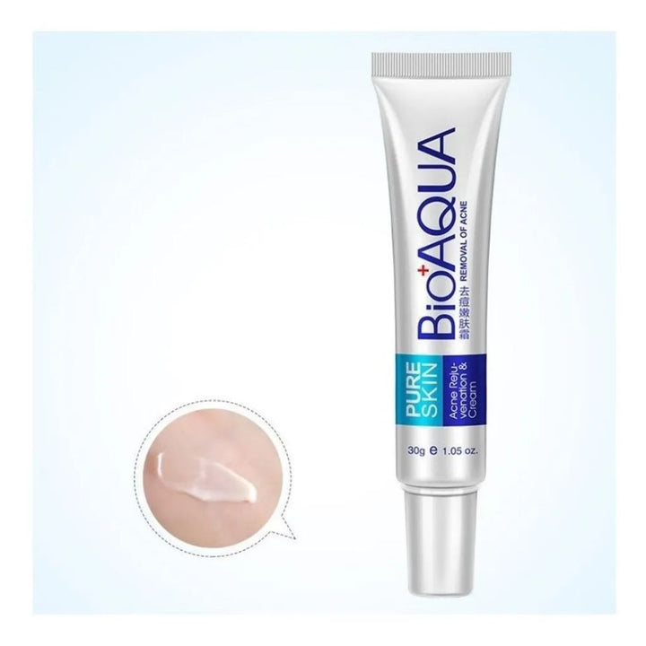 Crema Facial Removedora Acne 30g